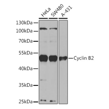 Western Blot - Anti-Cyclin B2 Antibody (A91816) - Antibodies.com