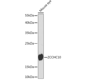 Western Blot - Anti-ZCCHC10 Antibody (A91817) - Antibodies.com