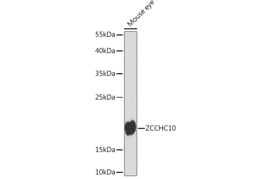 Western Blot - Anti-ZCCHC10 Antibody (A91817) - Antibodies.com