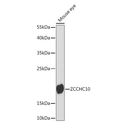 Western Blot - Anti-ZCCHC10 Antibody (A91817) - Antibodies.com