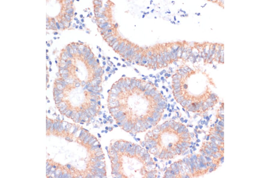 Immunohistochemistry - Anti-eIF4EBP1 Antibody (A91818) - Antibodies.com