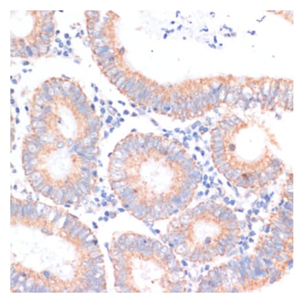 Immunohistochemistry - Anti-eIF4EBP1 Antibody (A91818) - Antibodies.com