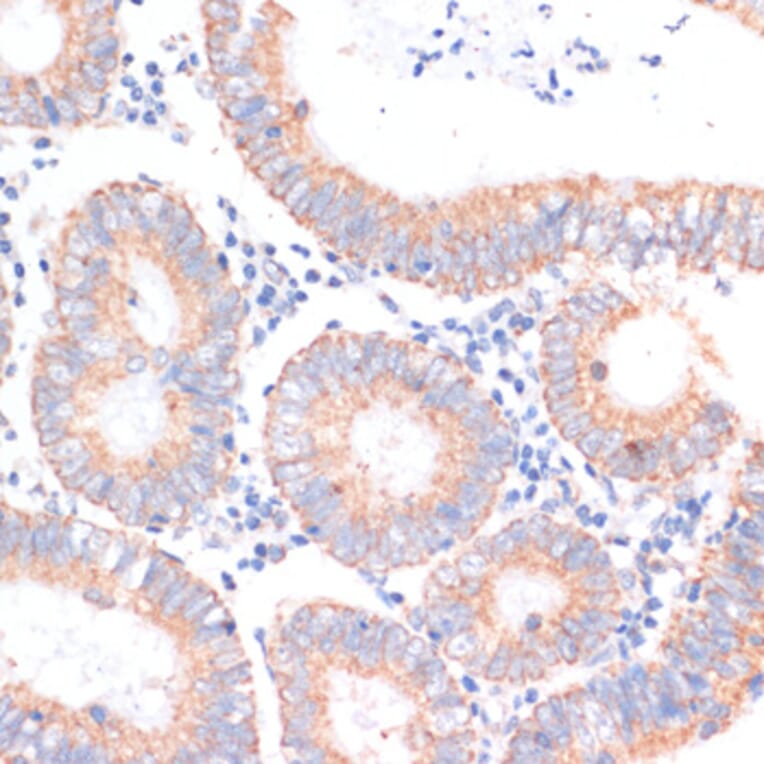 Immunohistochemistry - Anti-eIF4EBP1 Antibody (A91818) - Antibodies.com