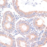 Immunohistochemistry - Anti-eIF4EBP1 Antibody (A91818) - Antibodies.com