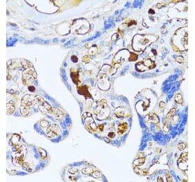 Immunohistochemistry - Anti-alpha 2 Macroglobulin Antibody (A91821) - Antibodies.com