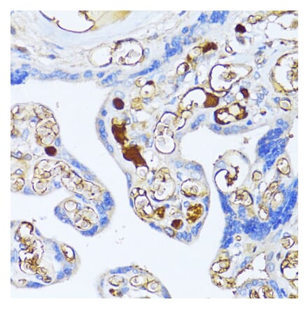 Immunohistochemistry - Anti-alpha 2 Macroglobulin Antibody (A91821) - Antibodies.com