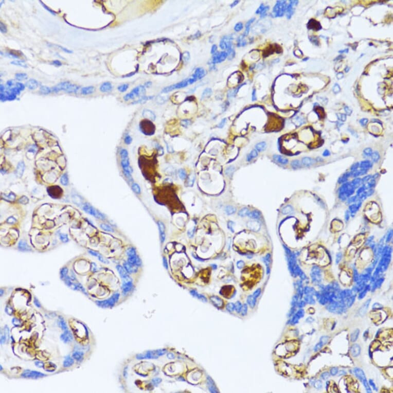 Immunohistochemistry - Anti-alpha 2 Macroglobulin Antibody (A91821) - Antibodies.com