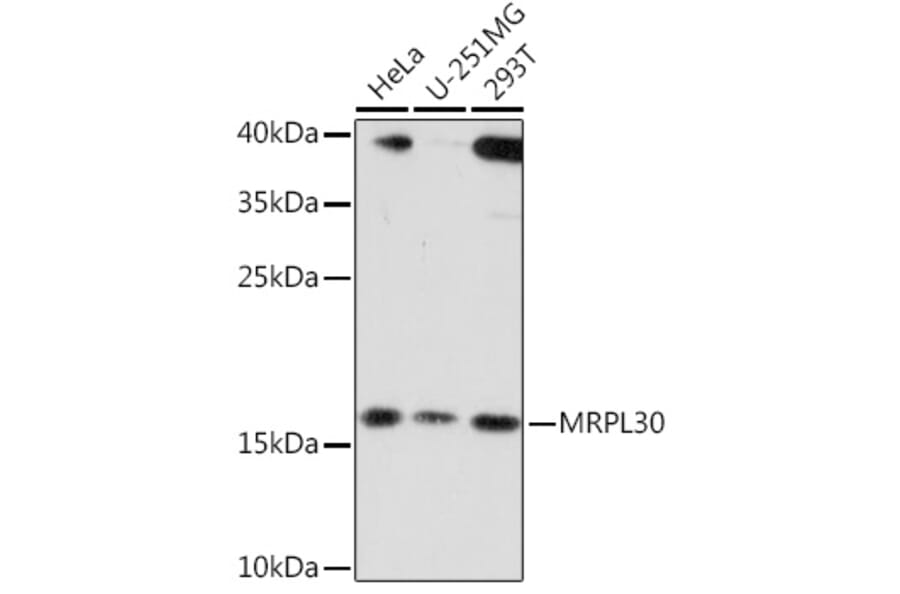Western Blot - Anti-MRPL30 Antibody (A91823) - Antibodies.com