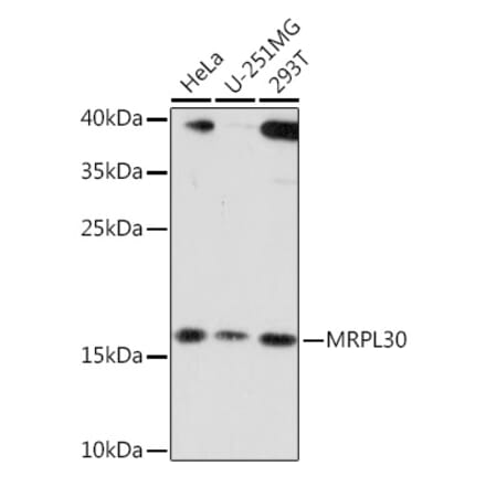 Western Blot - Anti-MRPL30 Antibody (A91823) - Antibodies.com