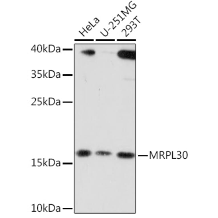 Western Blot - Anti-MRPL30 Antibody (A91823) - Antibodies.com