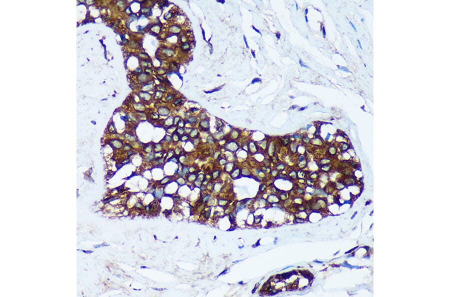 Immunohistochemistry - Anti-MRPL30 Antibody (A91823) - Antibodies.com