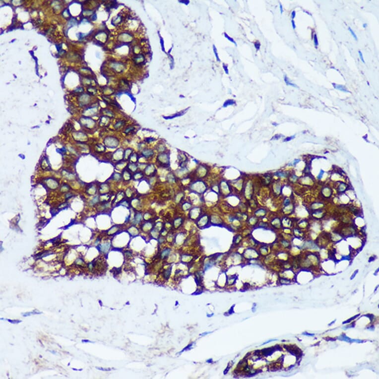 Immunohistochemistry - Anti-MRPL30 Antibody (A91823) - Antibodies.com