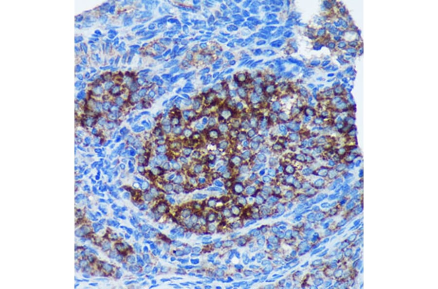 Immunohistochemistry - Anti-MRPL30 Antibody (A91823) - Antibodies.com