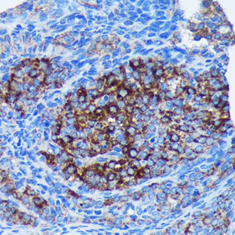 Immunohistochemistry - Anti-MRPL30 Antibody (A91823) - Antibodies.com