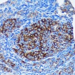 Immunohistochemistry - Anti-MRPL30 Antibody (A91823) - Antibodies.com