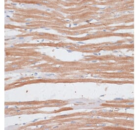 Immunohistochemistry - Anti-p60 katanin Antibody (A91824) - Antibodies.com