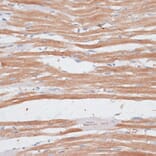 Immunohistochemistry - Anti-p60 katanin Antibody (A91824) - Antibodies.com
