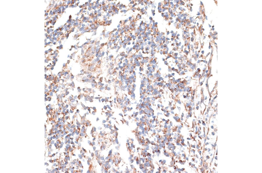 Immunohistochemistry - Anti-p60 katanin Antibody (A91824) - Antibodies.com
