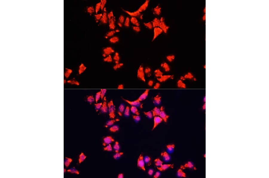 Immunofluorescence - Anti-ARF1 Antibody (A16345) - Antibodies.com