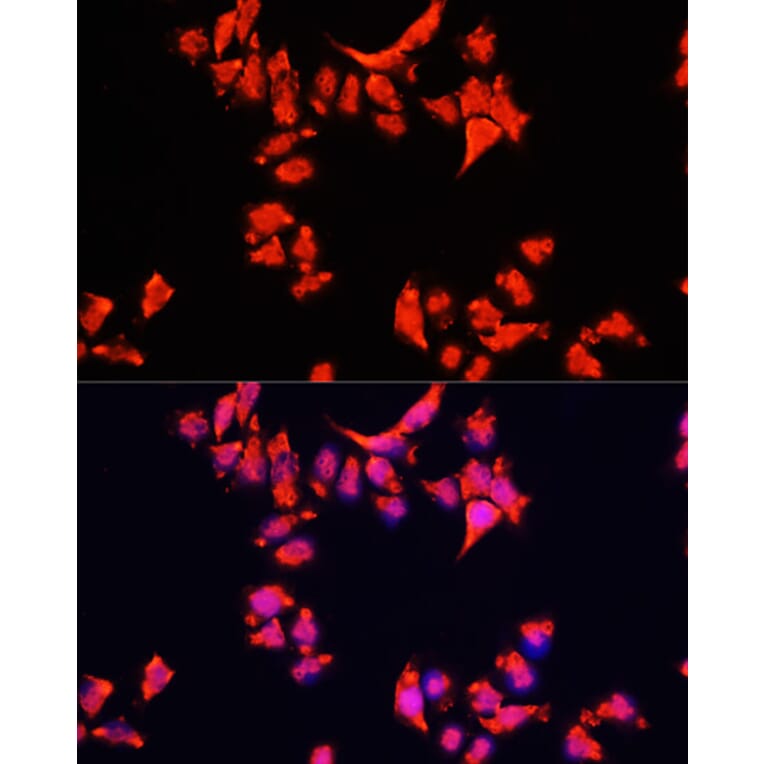 Immunofluorescence - Anti-ARF1 Antibody (A16345) - Antibodies.com