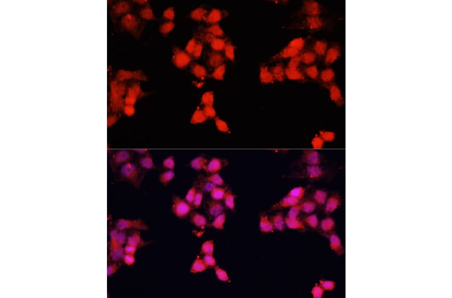 Immunofluorescence - Anti-ENO3 Antibody (A91826) - Antibodies.com