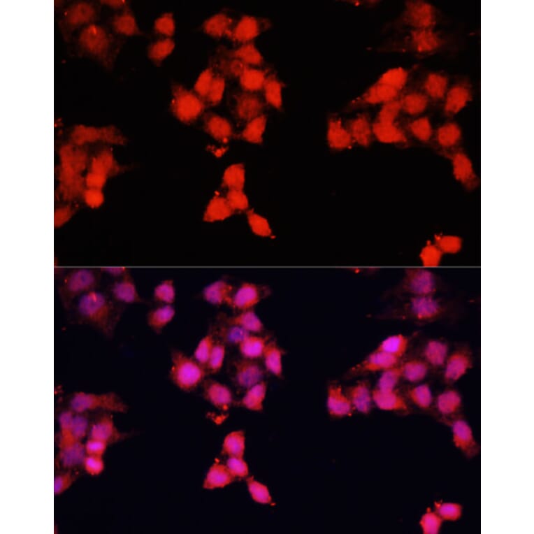 Immunofluorescence - Anti-ENO3 Antibody (A91826) - Antibodies.com