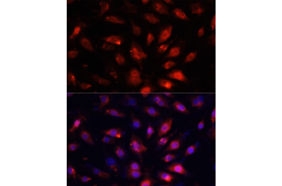 Immunofluorescence - Anti-ENO3 Antibody (A91826) - Antibodies.com
