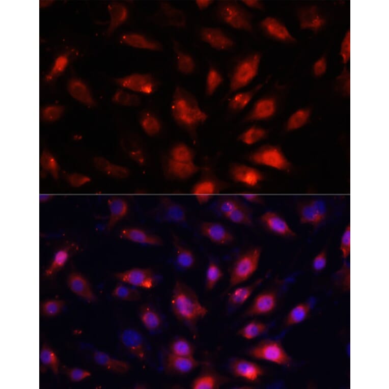 Immunofluorescence - Anti-ENO3 Antibody (A91826) - Antibodies.com