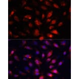 Immunofluorescence - Anti-ENO3 Antibody (A91826) - Antibodies.com