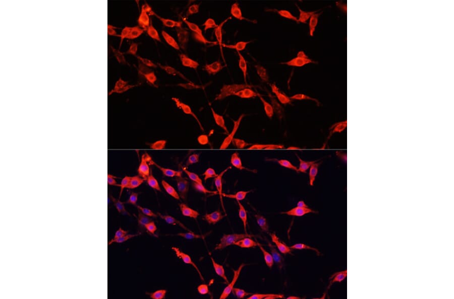 Immunofluorescence - Anti-ENO3 Antibody (A91826) - Antibodies.com