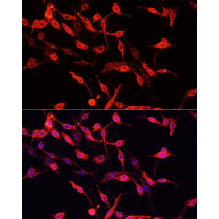 Immunofluorescence - Anti-ENO3 Antibody (A91826) - Antibodies.com