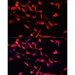 Immunofluorescence - Anti-ENO3 Antibody (A91826) - Antibodies.com