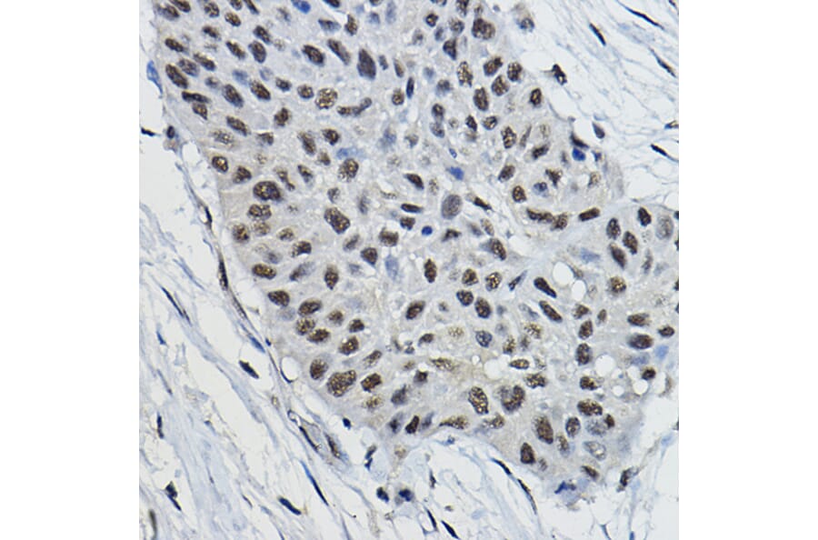 Immunohistochemistry - Anti-BRAP Antibody (A91827) - Antibodies.com