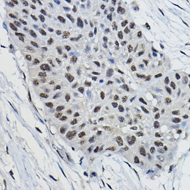 Immunohistochemistry - Anti-BRAP Antibody (A91827) - Antibodies.com