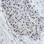 Immunohistochemistry - Anti-BRAP Antibody (A91827) - Antibodies.com