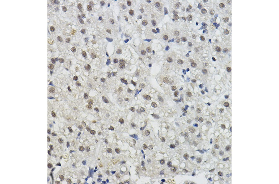 Immunohistochemistry - Anti-BRAP Antibody (A91827) - Antibodies.com