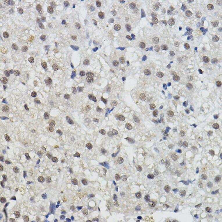 Immunohistochemistry - Anti-BRAP Antibody (A91827) - Antibodies.com