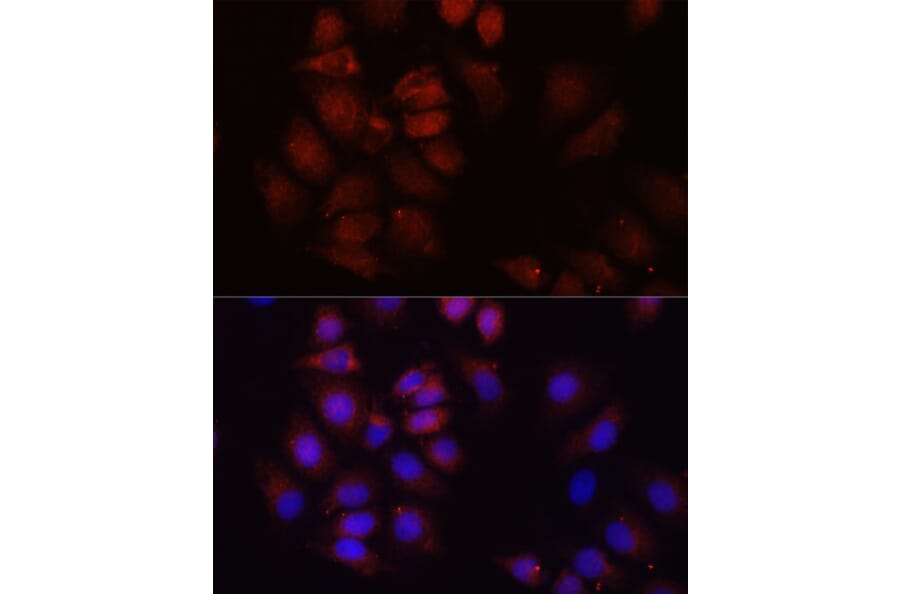 Immunofluorescence - Anti-HRNR Antibody (A16620) - Antibodies.com