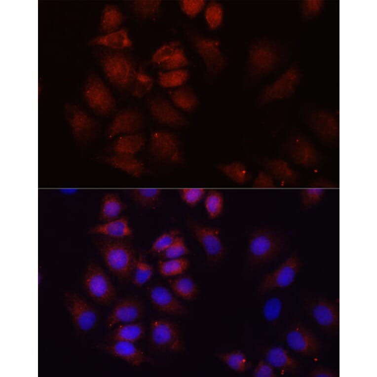 Immunofluorescence - Anti-HRNR Antibody (A16620) - Antibodies.com