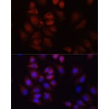 Immunofluorescence - Anti-HRNR Antibody (A16620) - Antibodies.com