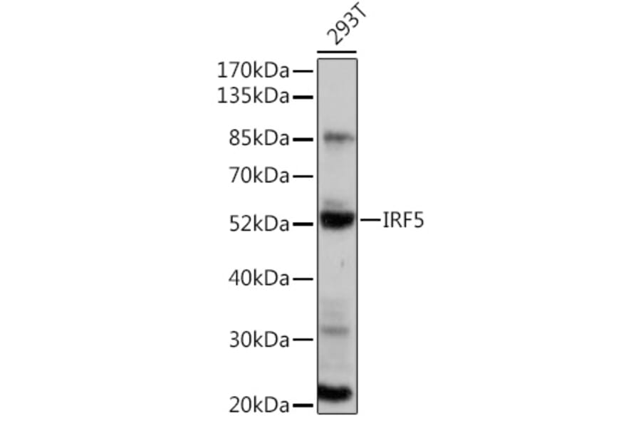 Western Blot - Anti-IRF5 Antibody (A91829) - Antibodies.com