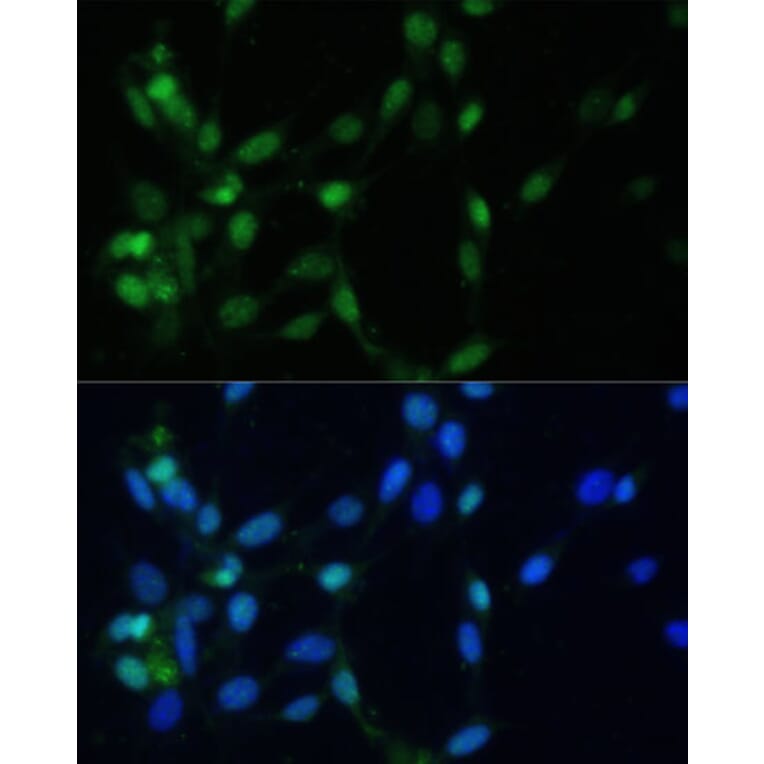 Immunofluorescence - Anti-Mad2L1 Antibody (A91830) - Antibodies.com