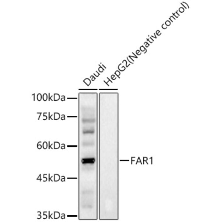 Western Blot - Anti-FAR1 Antibody (A91832) - Antibodies.com