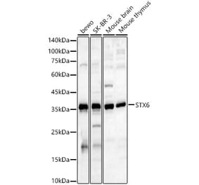 Western Blot - Anti-Syntaxin 6 Antibody (A91833) - Antibodies.com