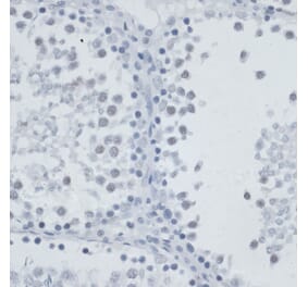 Immunohistochemistry - Anti-MSH6 Antibody (A91837) - Antibodies.com