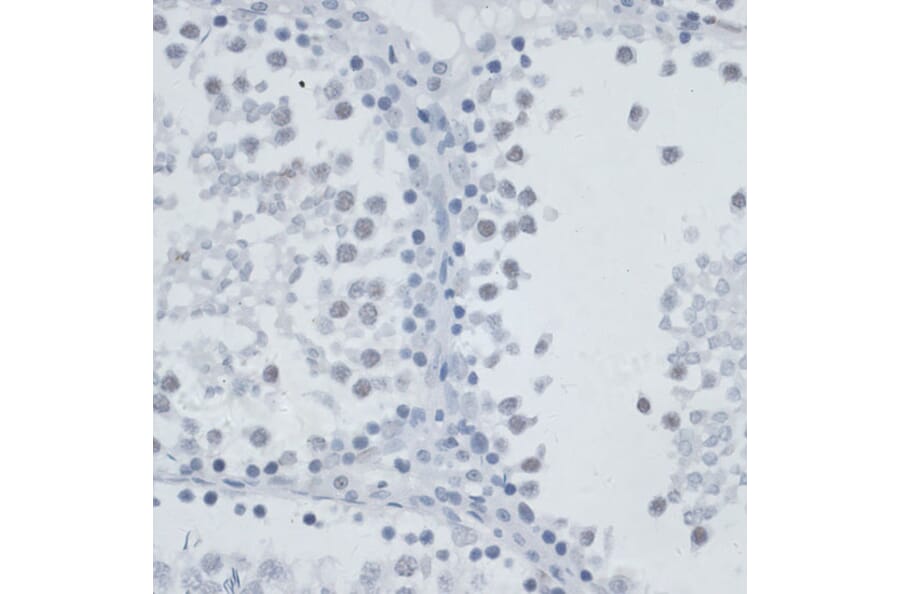 Immunohistochemistry - Anti-MSH6 Antibody (A91837) - Antibodies.com