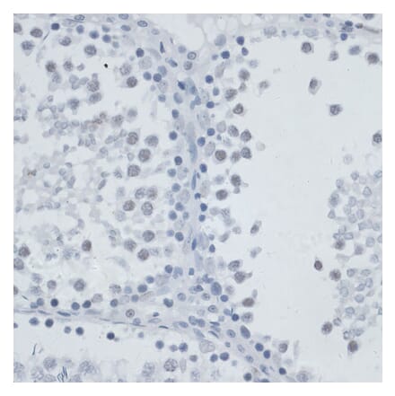 Immunohistochemistry - Anti-MSH6 Antibody (A91837) - Antibodies.com