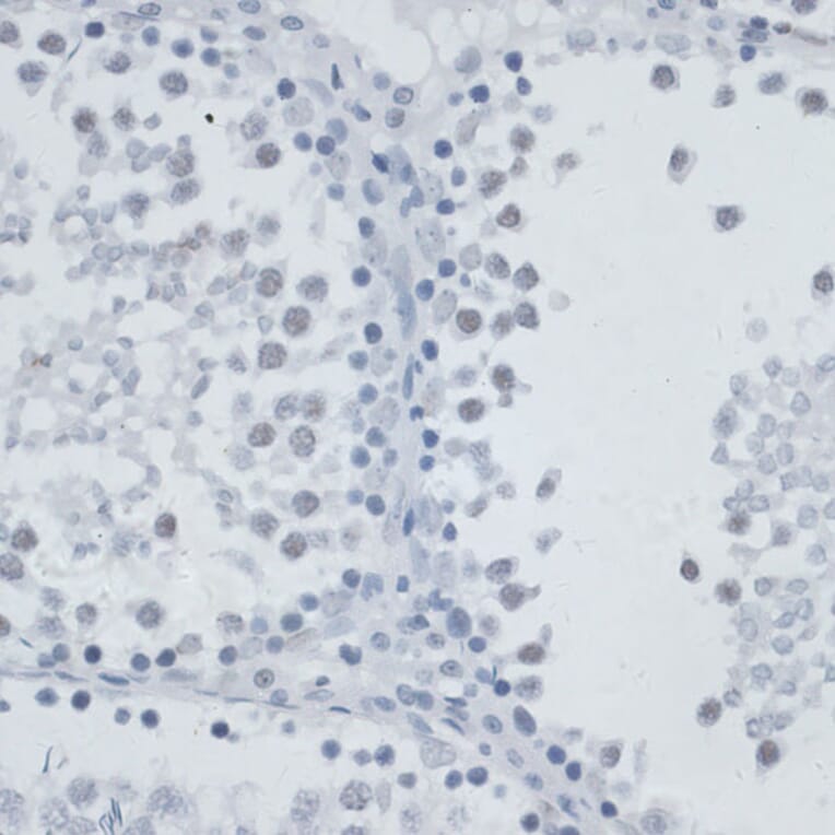 Immunohistochemistry - Anti-MSH6 Antibody (A91837) - Antibodies.com