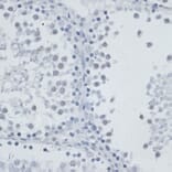 Immunohistochemistry - Anti-MSH6 Antibody (A91837) - Antibodies.com