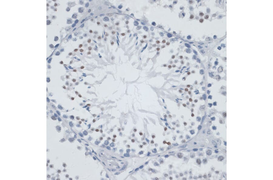 Immunohistochemistry - Anti-MSH6 Antibody (A91837) - Antibodies.com